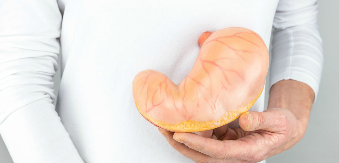 کاهش حجم معده با روش های طبیعی (غیر از جراحی)